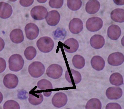 can-tick-bite-cause-low-platelets-in-dogs